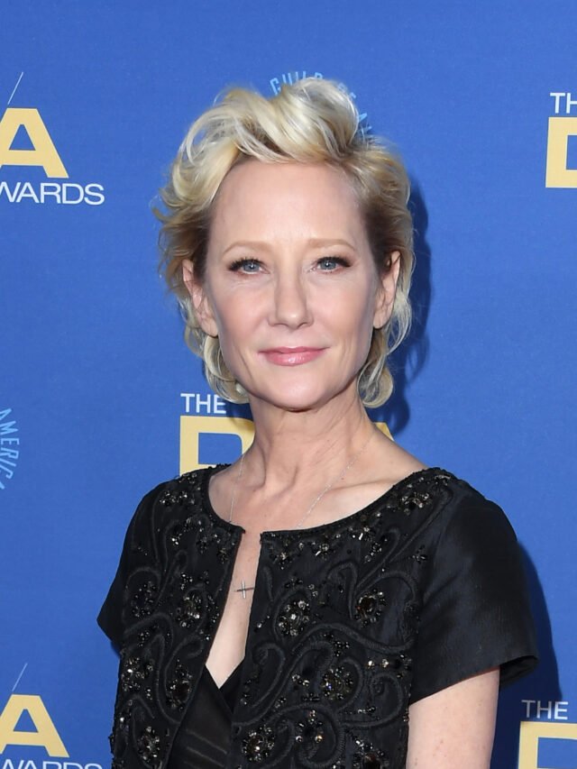 Anne Heche Severely Burned - CelebrityDose